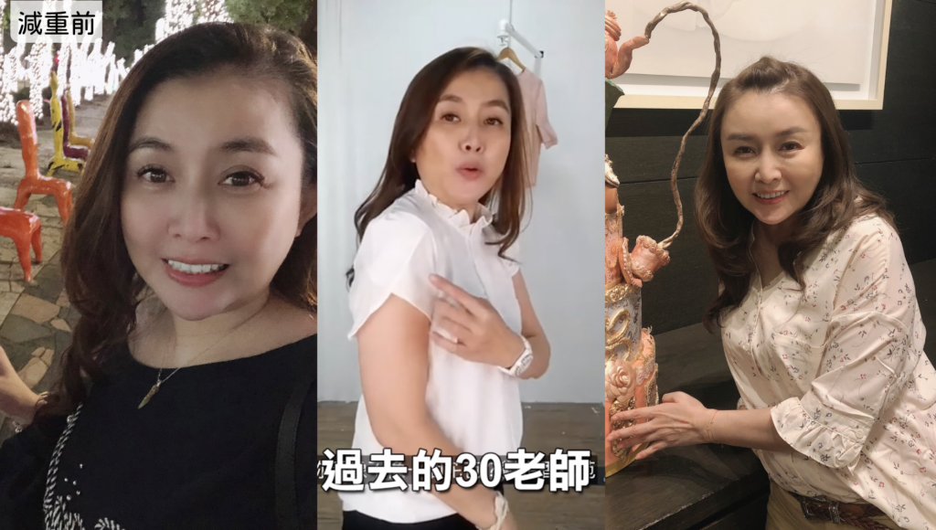 30老師before減重療程前