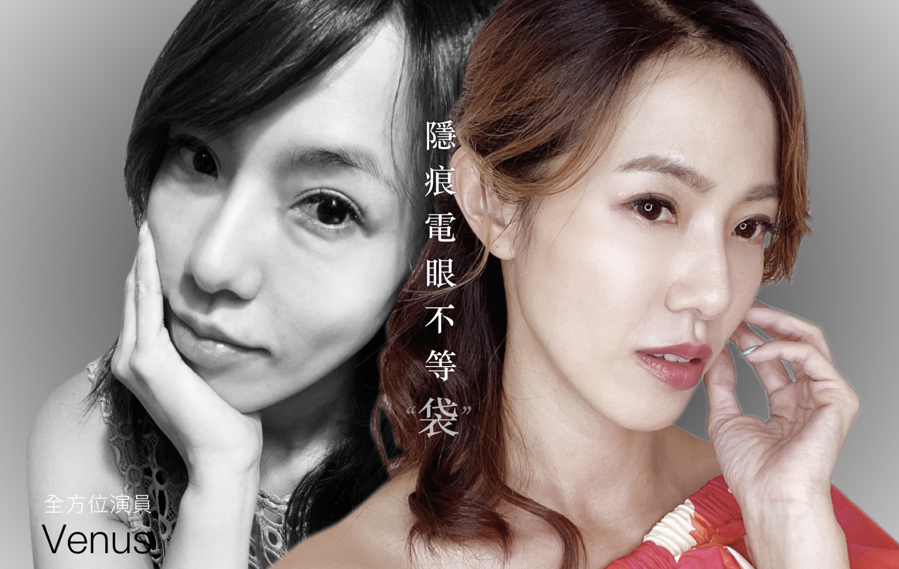 隱痕眼袋淚溝術